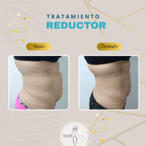 Prosculpt